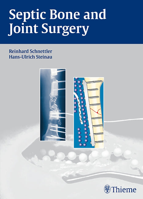 Septic Bone and Joint Surgery - Ingram