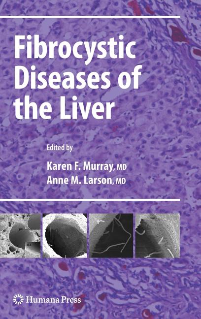 Fibrocystic Diseases of the Liver - Ingram