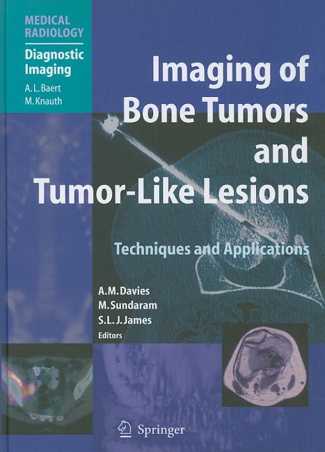 Imaging of Bone Tumors and Tumor-Like Lesions: Techniques and Applications (2009) - Ingram