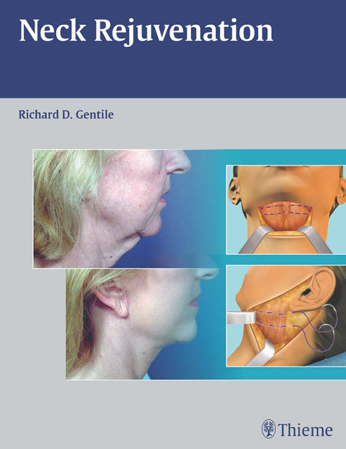 Neck Rejuvenation - Ingram
