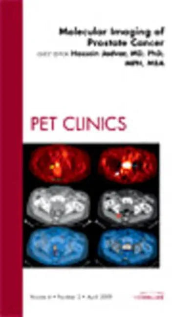 Molecular Imaging of Prostate Cancer, an Issue of Pet Clinics: Volume 4-2 - stevensbooks