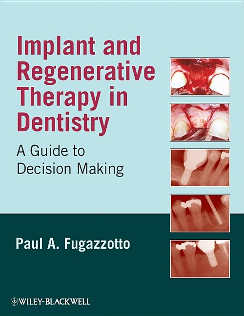 Implant and Regenerative Thera - Ingram