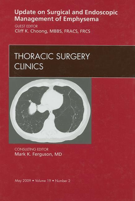 Update on Surgical and Endoscopic Management of Emphysema, an Issue of Thoracic Surgery Clinics: Volume 19-2 - stevensbooks