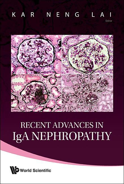 Recent Advances in IGA Nephropathy - stevensbooks