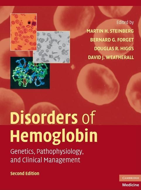 Disorders of Hemoglobin: Genetics, Pathophysiology, and Clinical Management (Revised) - stevensbooks