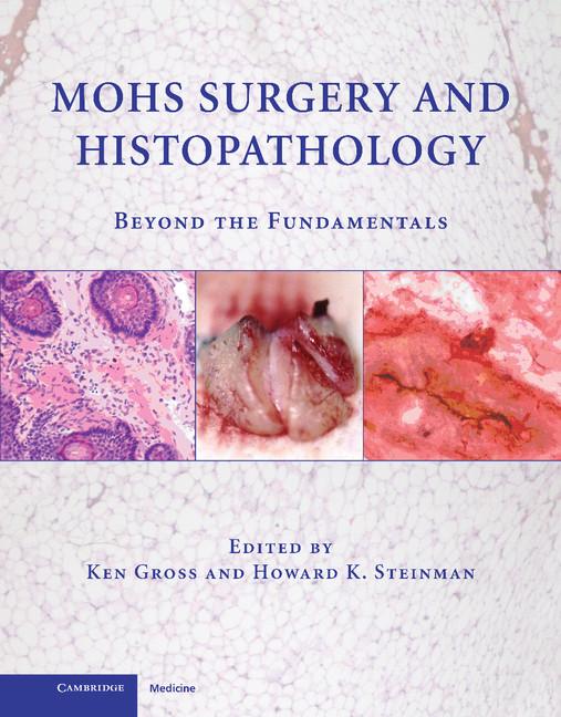 Mohs Surgery and Histopathology: Beyond the Fundamentals - Ingram