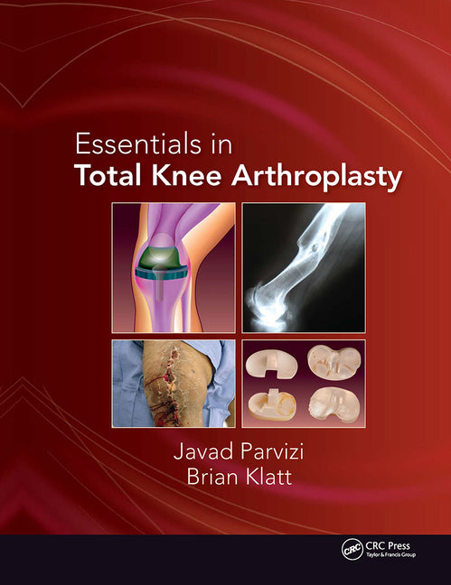 Essentials in Total Knee Arthroplasty - Ingram