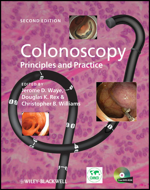 Colonoscopy: Principles and Practice [With DVD ROM] - Ingram