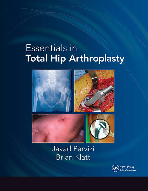 Essentials in Total Hip Arthroplasty - Ingram