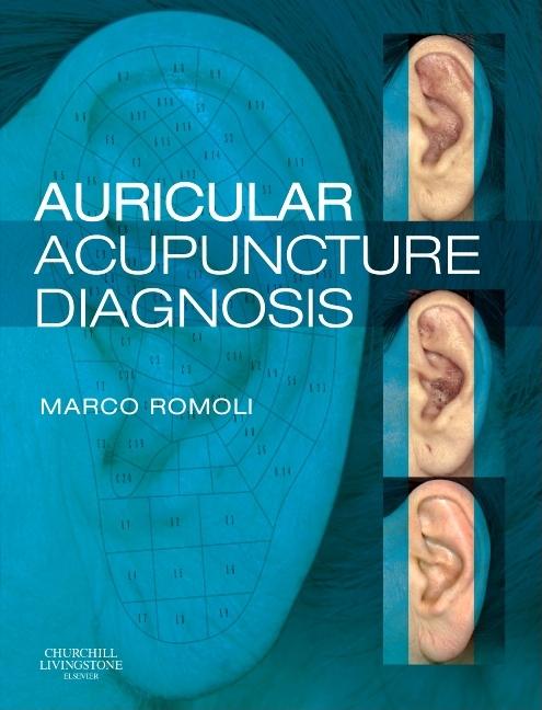 Auricular Acupuncture Diagnosis - Ingram