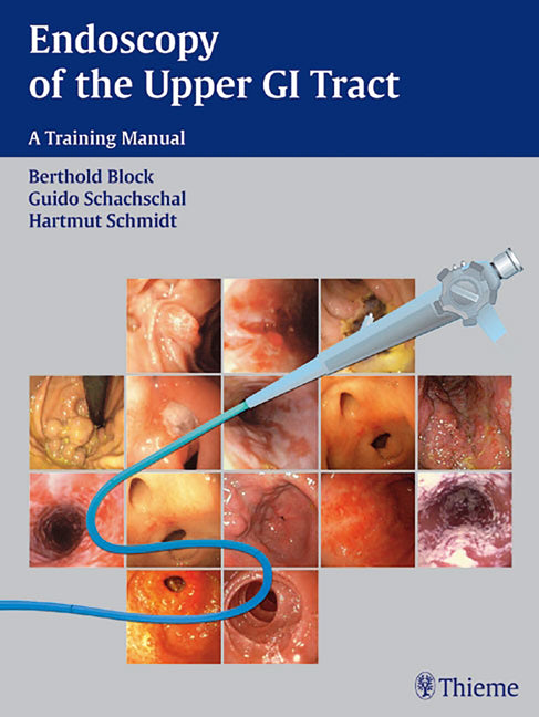 Endoscopy of the Upper GI Tract: A Training Manual - Ingram