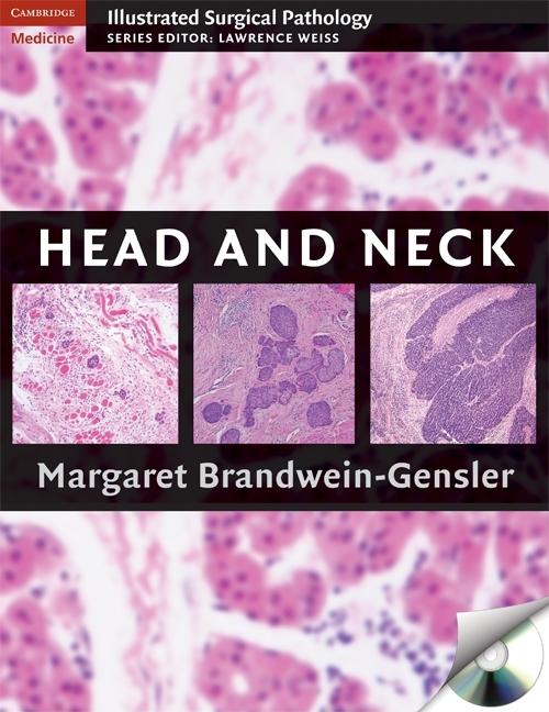 Head and Neck [With CDROM] - Ingram
