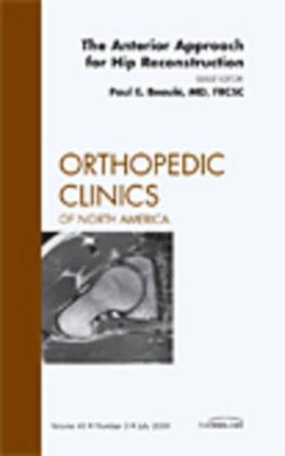 Anterior Approach for Hip Reconstruction, an Issue of Orthopedic Clinics: Volume 40-3 - Ingram