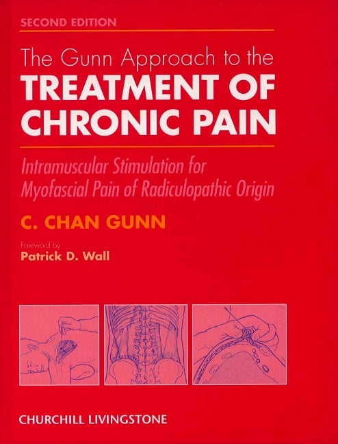 Gunn Approach to the Treatment of Chronic Pain: Intramuscular Stimulation for Myofascial Pain of Radiculopathic Origin (Revised) - Ingram