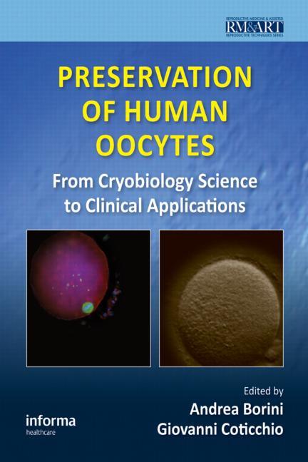 Preservation of Human Oocytes: From Cryobiology Science to Clinical Applications - Ingram
