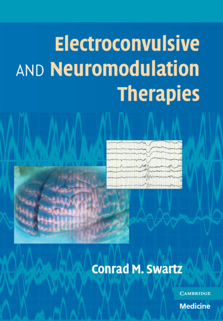 Electroconvulsive and Neuromodulation Therapy - Ingram