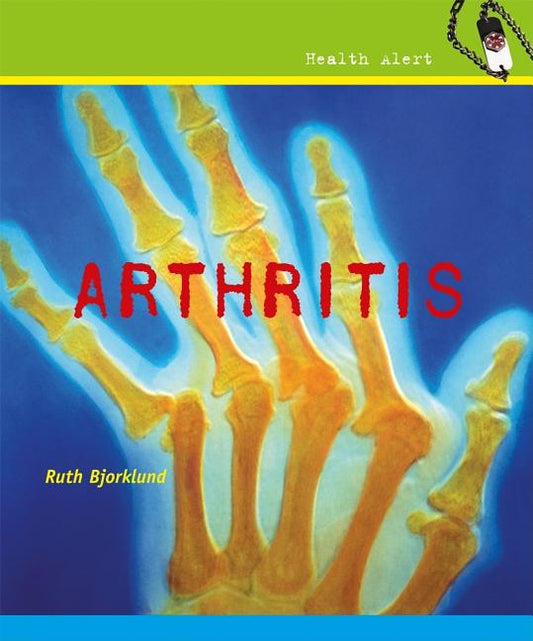 Arthritis - Ingram