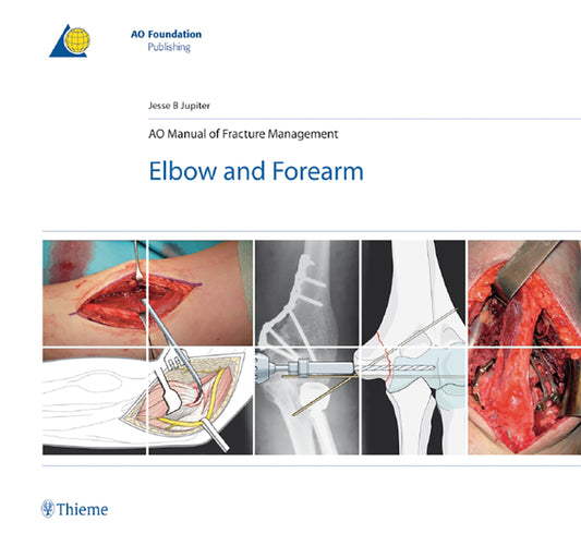 Ao Manual of Fracture Management - Elbow & Forearm - Ingram