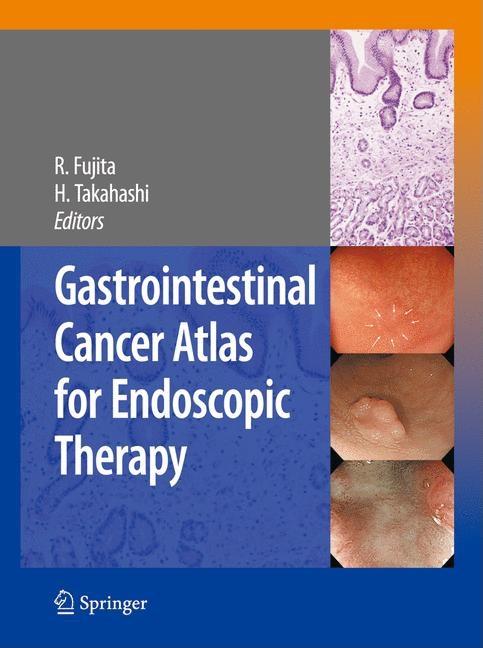 Gastrointestinal Cancer Atlas for Endoscopic Therapy (2009) - Ingram